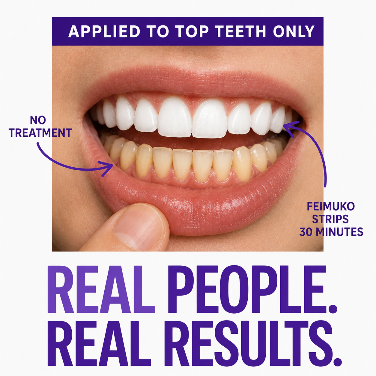 Feimuko Purple Teeth Whitening Strips