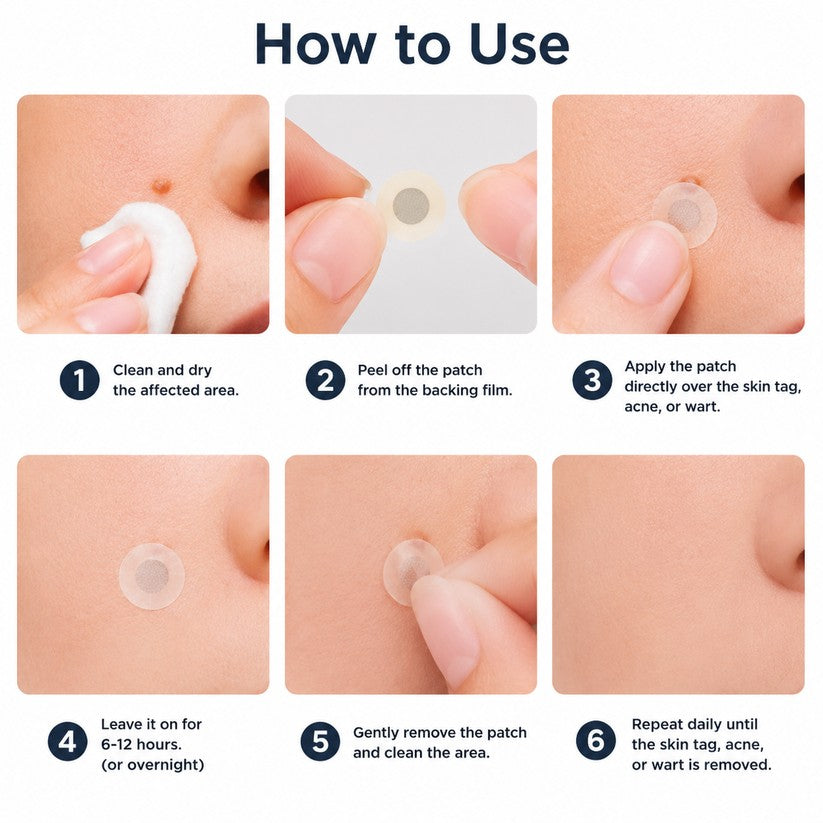 🌟XiMonth MICRONEEDLEBOTANIC SKIN TAG SOLUTION PATCH  InvisibleFace & Body Patches for RaisedMoles, Acne, Flat Warts & SkinTags -Helps Improve theAppearance of Wrinkles, Scars &Blemishes