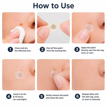 🌟XiMonth MICRONEEDLEBOTANIC SKIN TAG SOLUTION PATCH  InvisibleFace & Body Patches for RaisedMoles, Acne, Flat Warts & SkinTags -Helps Improve theAppearance of Wrinkles, Scars &Blemishes