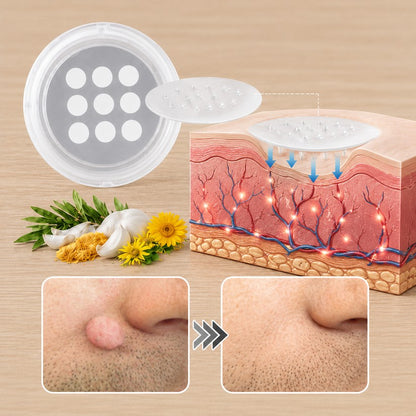 🌟XiMonth MICRONEEDLEBOTANIC SKIN TAG SOLUTION PATCH  InvisibleFace & Body Patches for RaisedMoles, Acne, Flat Warts & SkinTags -Helps Improve theAppearance of Wrinkles, Scars &Blemishes
